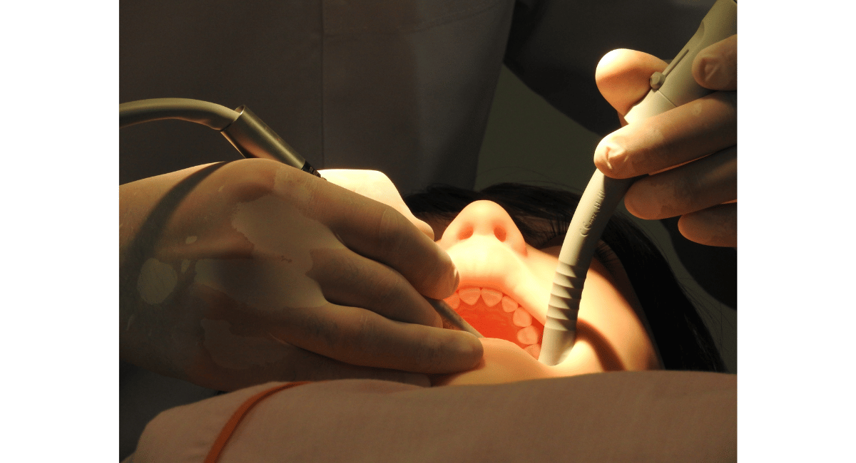 DENTAROID（デンタロイド）