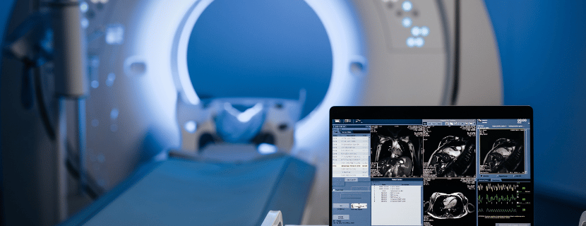 自社の目的に合ったCTスキャナを導入するための製品の選び方を解説